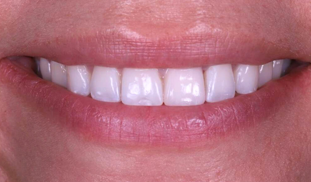 After -Dr Nina Shaffie