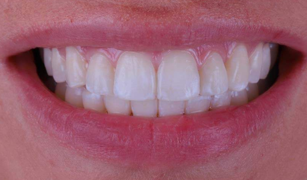 After -Dr Nina Shaffie