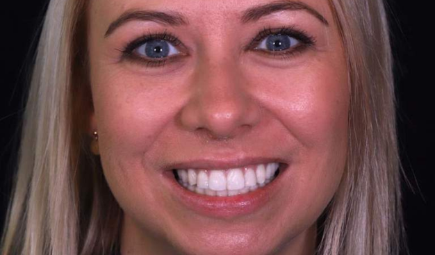 After -Dr Nina Shaffie