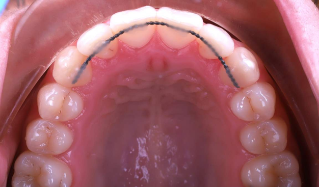 After -Dr Nina Shaffie