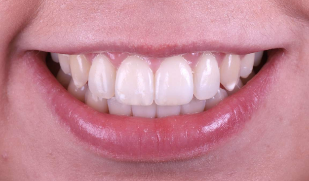 After -Dr Nina Shaffie