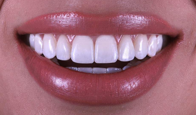 After -Dr Nina Shaffie