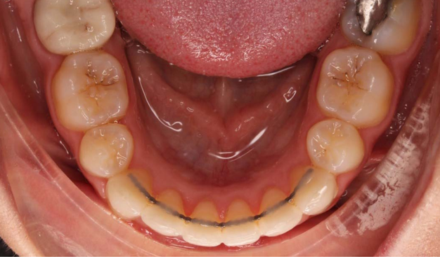 After -Dr Nina Shaffie