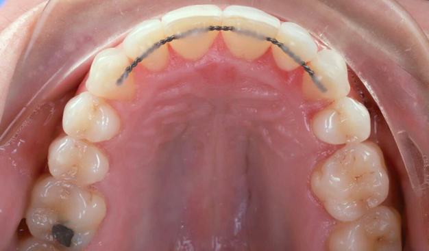 After -Dr Nina Shaffie