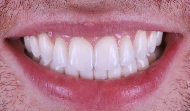 After -Dr Nina Shaffie