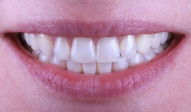 After -Dr Nina Shaffie