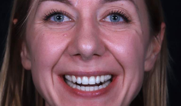 After -Dr Nina Shaffie