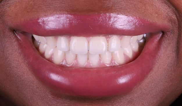 After -Dr Nina Shaffie