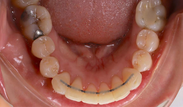 After -Dr Nina Shaffie