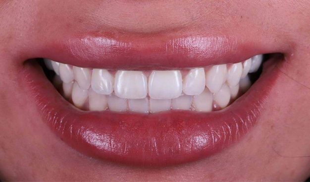 After -Dr Nina Shaffie