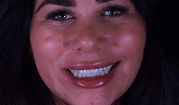 After -Dr Nina Shaffie