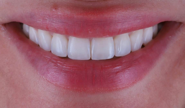 After -Dr Nina Shaffie