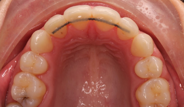 After -Dr Nina Shaffie