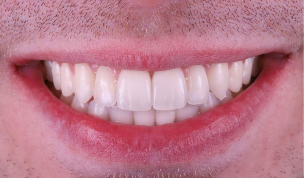 After -Dr Nina Shaffie