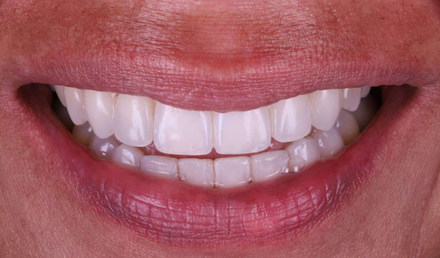 After -Dr Nina Shaffie