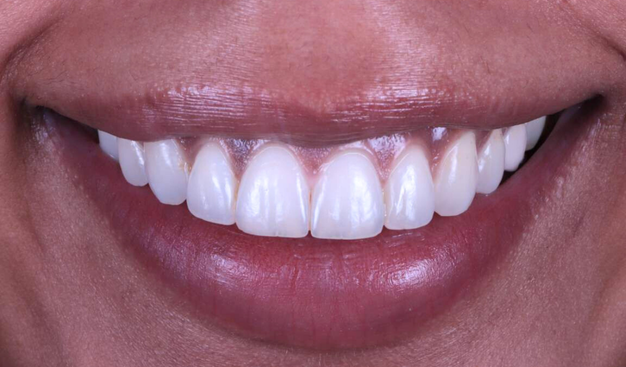 After -Dr Nina Shaffie