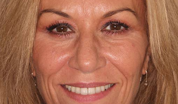 After -Dr Nina Shaffie