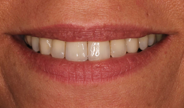 After -Dr Nina Shaffie