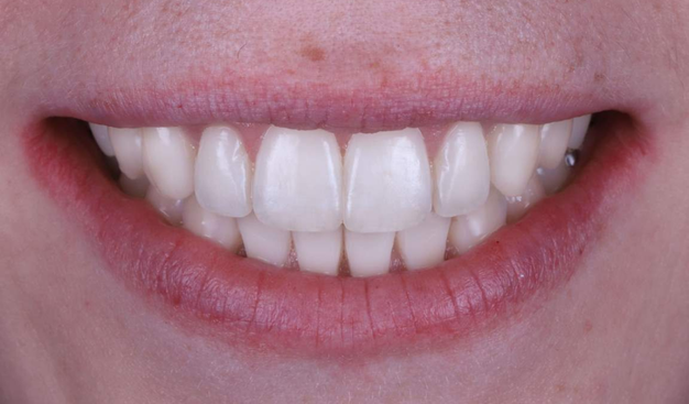 After -Dr Nina Shaffie