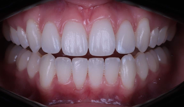 After -Dr Nina Shaffie