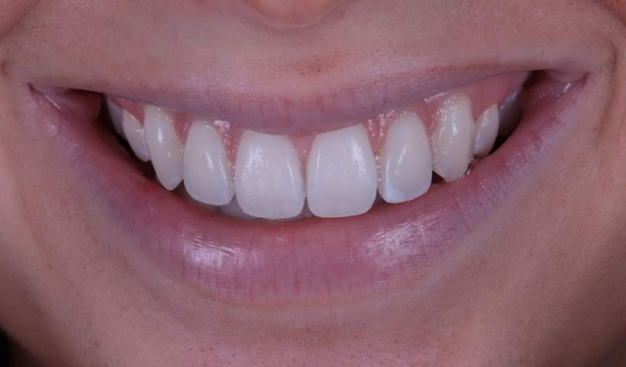 After -Dr Nina Shaffie