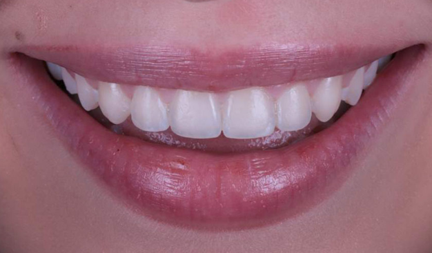 After -Dr Nina Shaffie