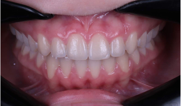 After -Dr Nina Shaffie