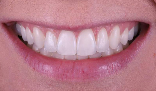 After -Dr Nina Shaffie