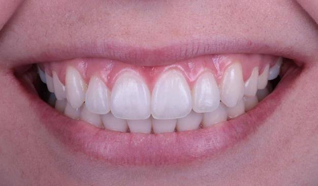 After -Dr Nina Shaffie