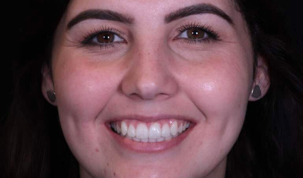 After -Dr Nina Shaffie