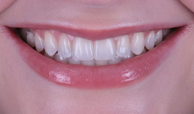 After -Dr Nina Shaffie