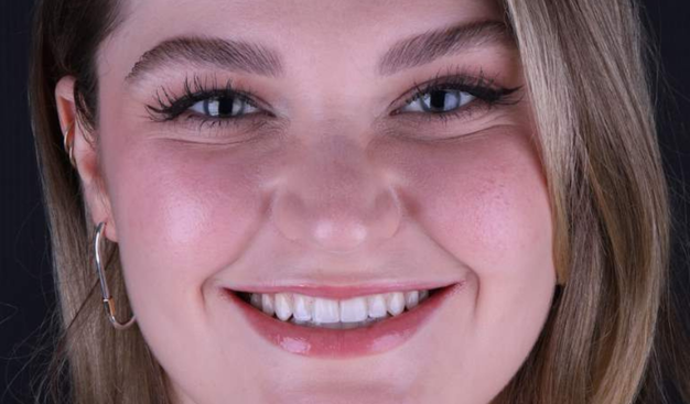 After -Dr Nina Shaffie