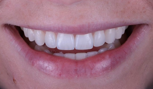 After -Dr Nina Shaffie