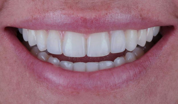 After -Dr Nina Shaffie