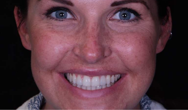 After -Dr Nina Shaffie