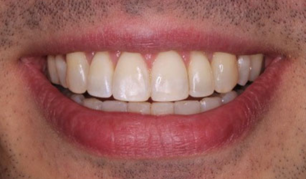 After -Dr Nina Shaffie