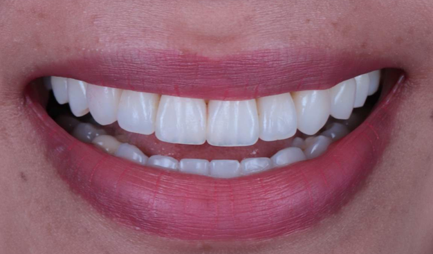 After -Dr Nina Shaffie