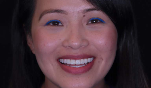 After -Dr Nina Shaffie