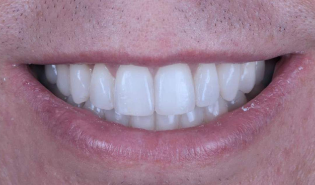 After -Dr Nina Shaffie