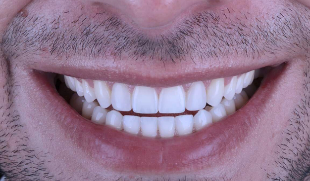 After -Dr Nina Shaffie