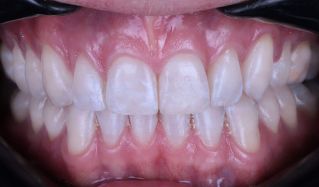 After -Dr Nina Shaffie