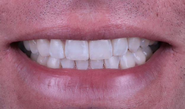 After -Dr Nina Shaffie