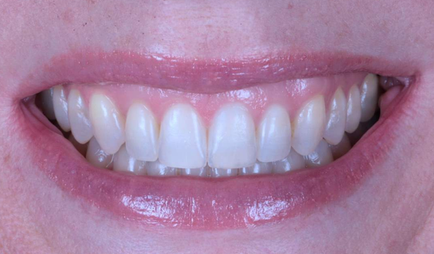 After -Dr Nina Shaffie