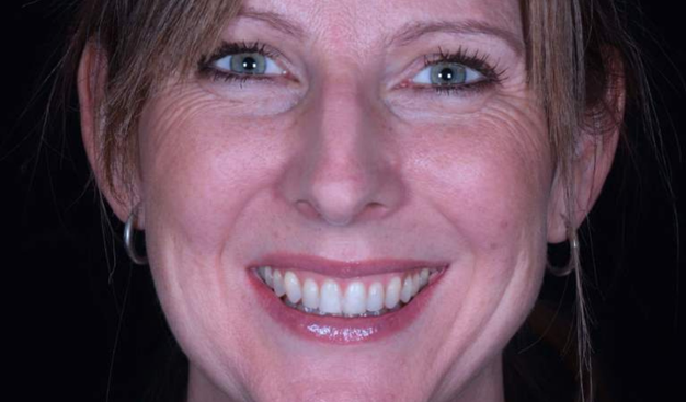 After -Dr Nina Shaffie