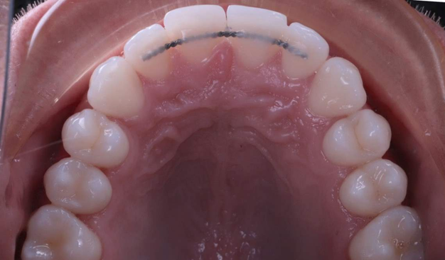 After -Dr Nina Shaffie