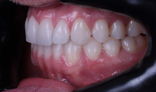 After -Dr Nina Shaffie