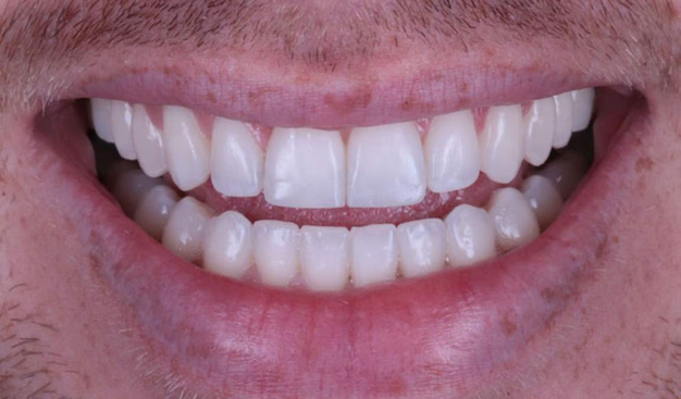 After -Dr Nina Shaffie