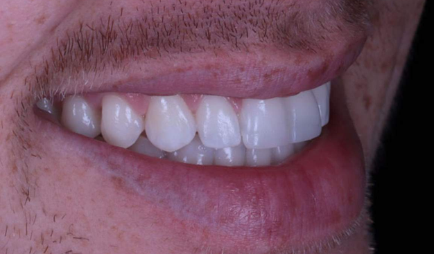 After -Dr Nina Shaffie