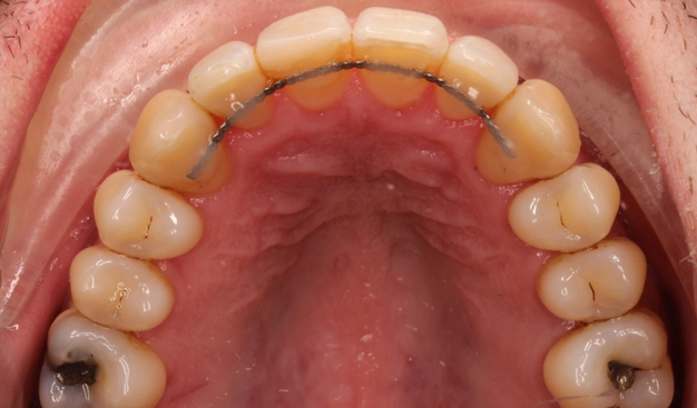 After -Dr Nina Shaffie