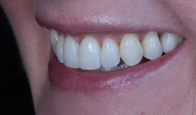 After -Dr Nina Shaffie